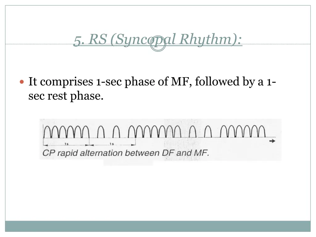 5 rs syncopal rhythm