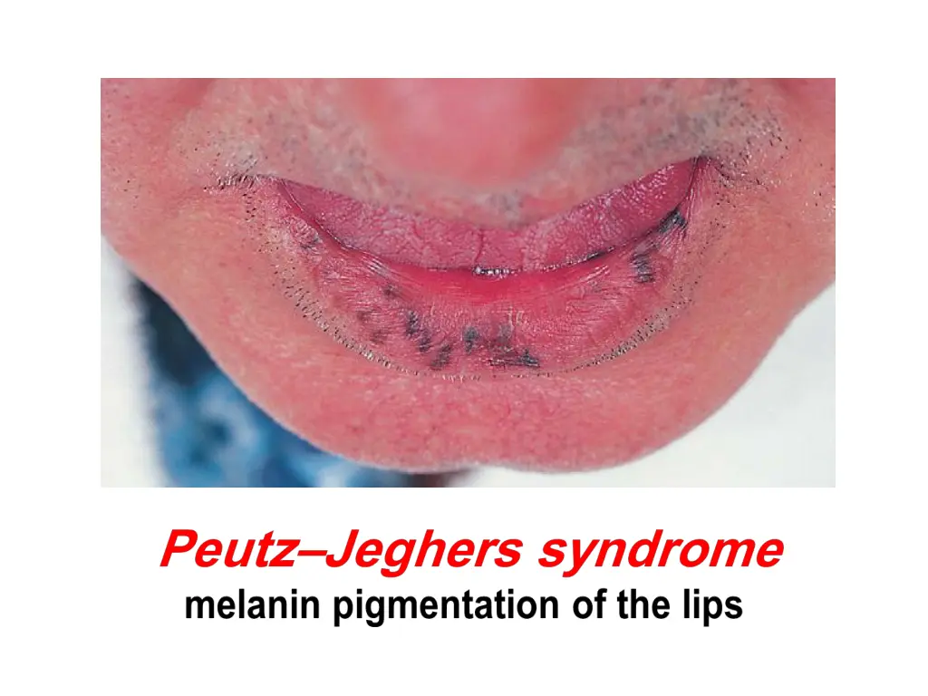 slide12