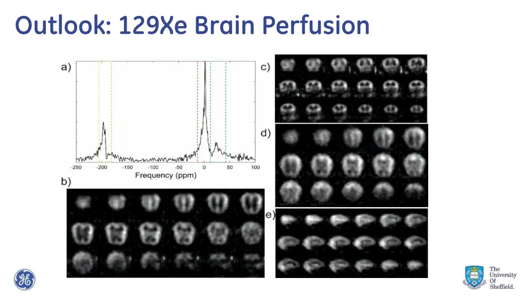 outlook 129xe brain perfusion