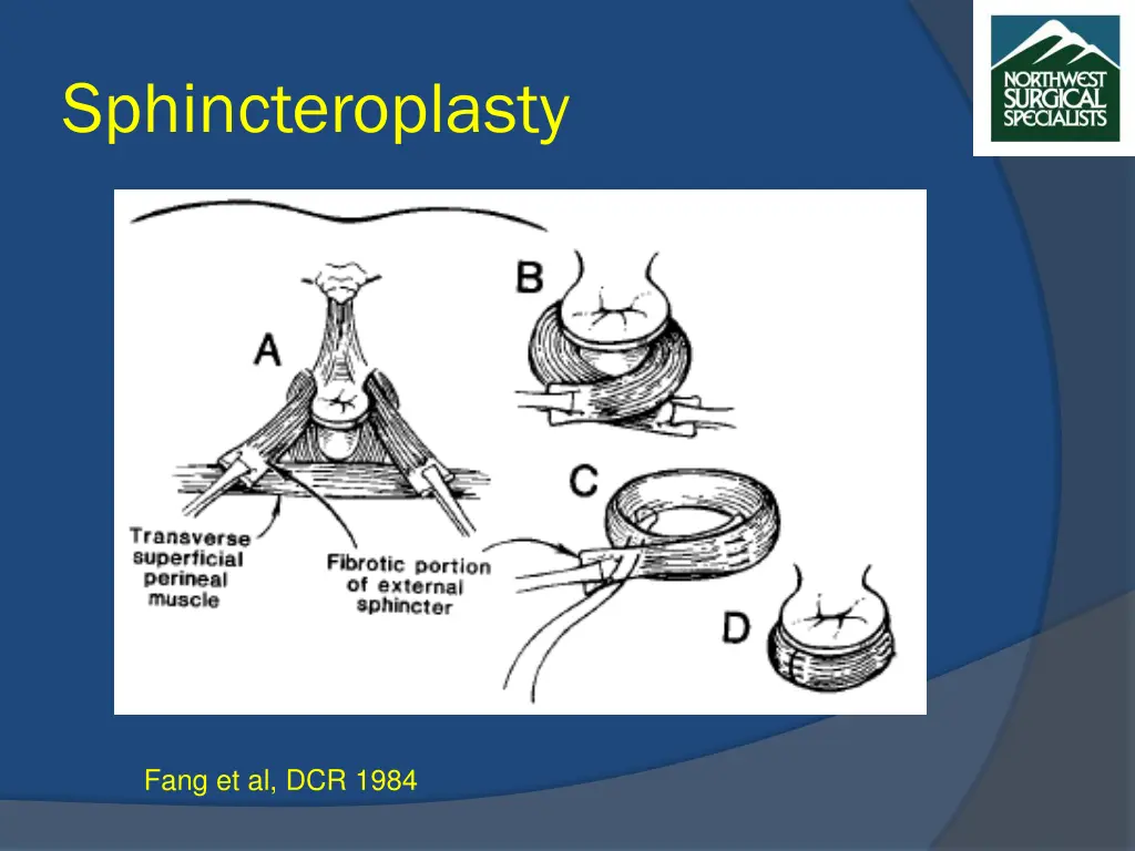 sphincteroplasty