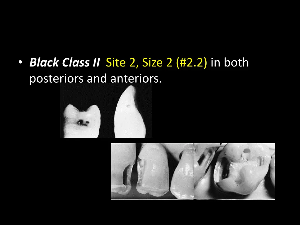 black class ii site 2 size 2 2 2 in both