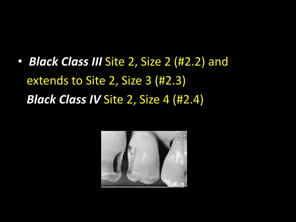 black class iii site 2 size 2 2 2 and extends