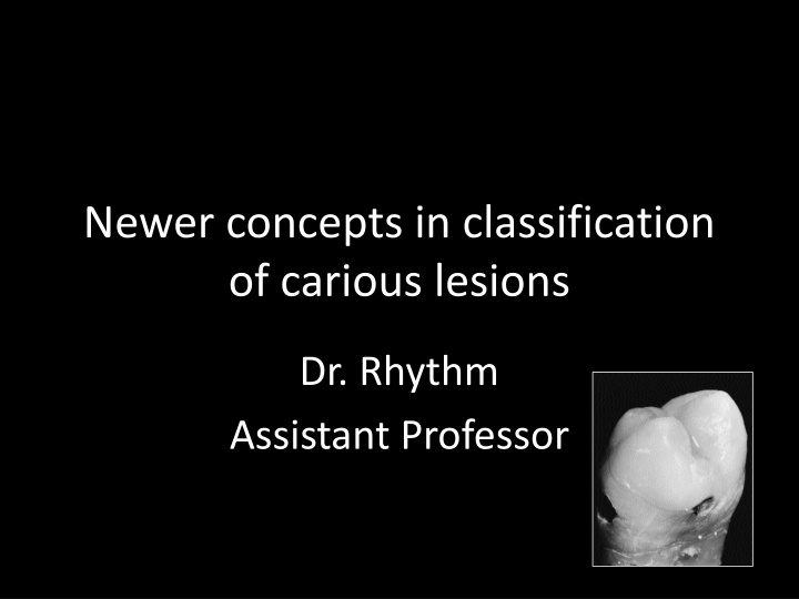 newer concepts in classification of carious
