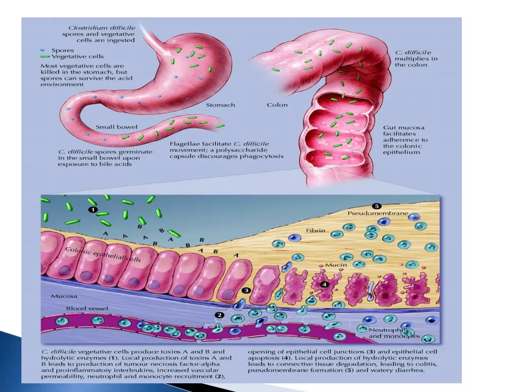 slide33