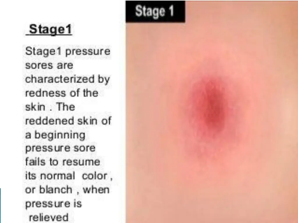slide17