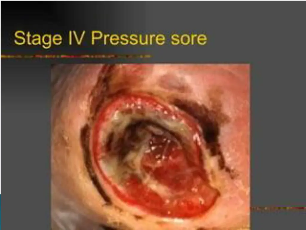 slide23