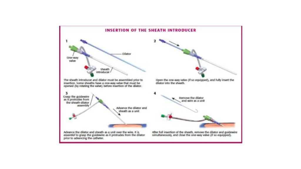slide15