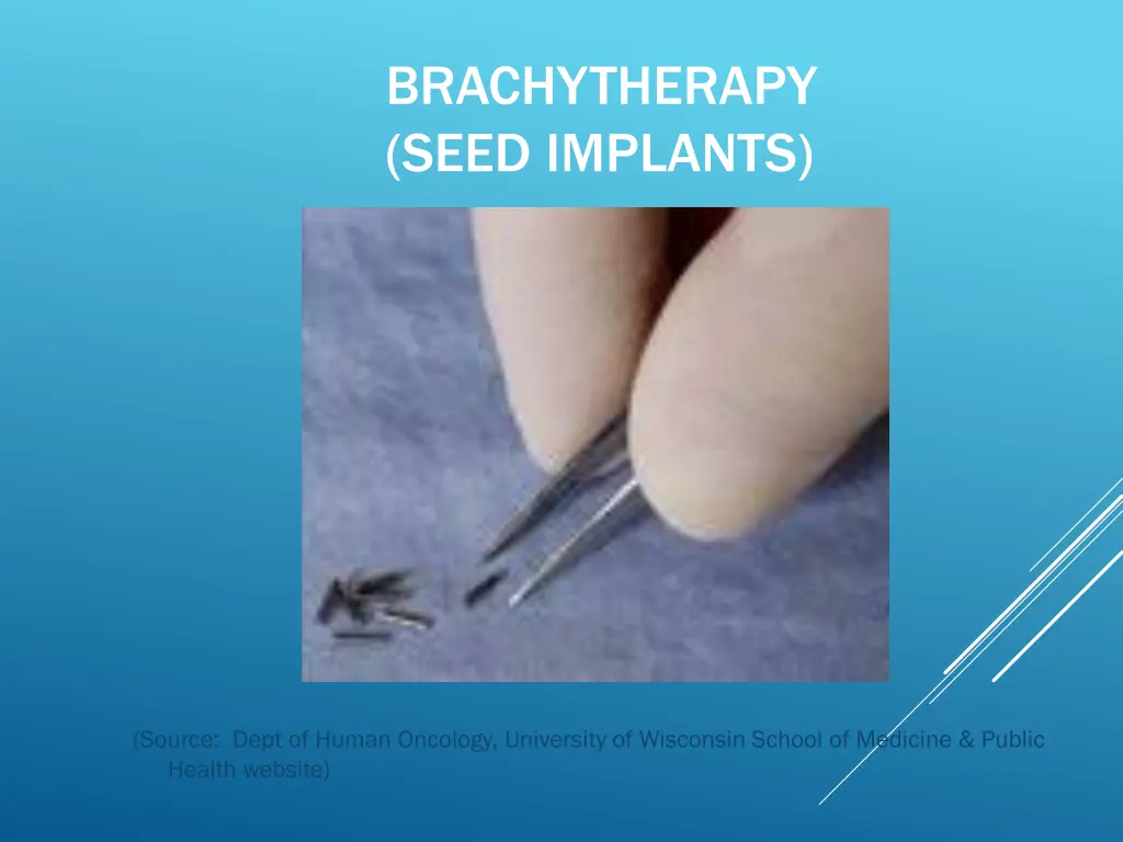 brachytherapy seed implants