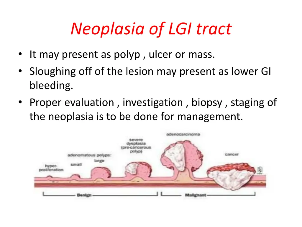 neoplasia of lgi tract