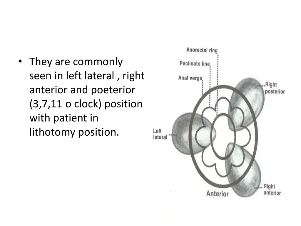 they are commonly seen in left lateral right
