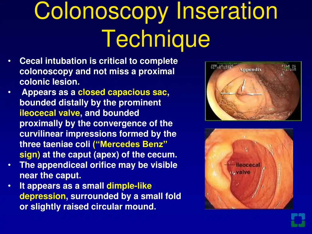colonoscopy inseration technique cecal intubation