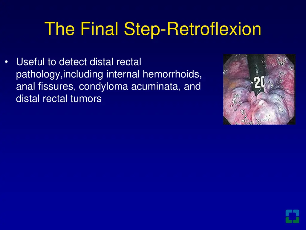the final step retroflexion 1