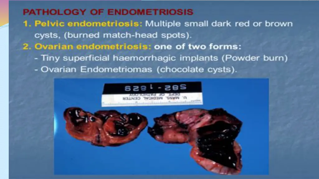 slide4