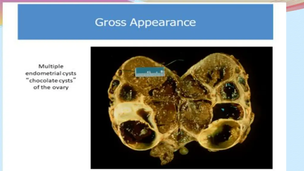 slide5