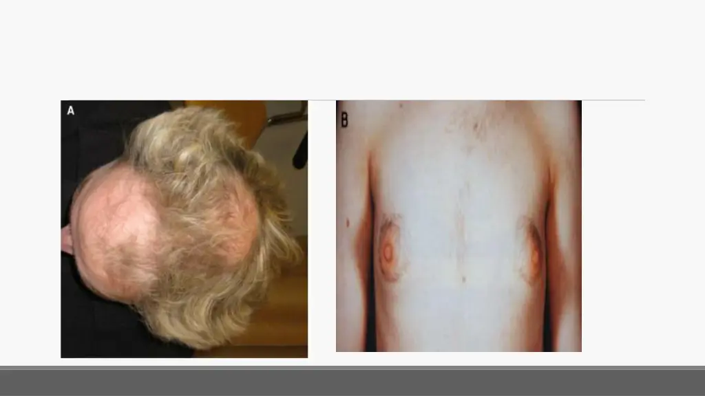 slide32