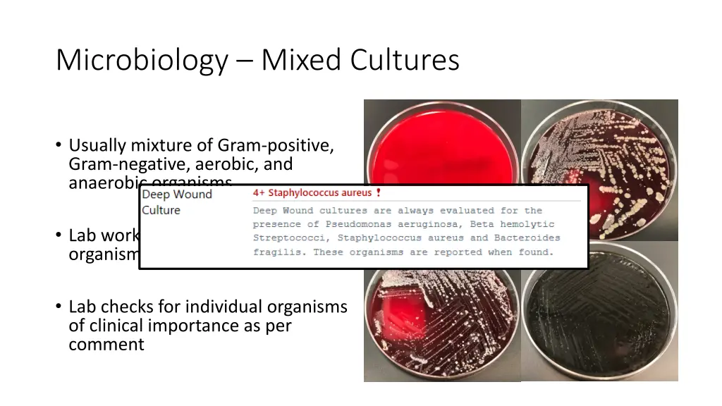 microbiology mixed cultures