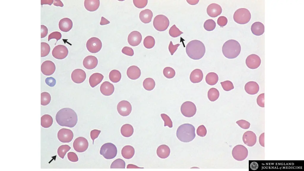 slide36