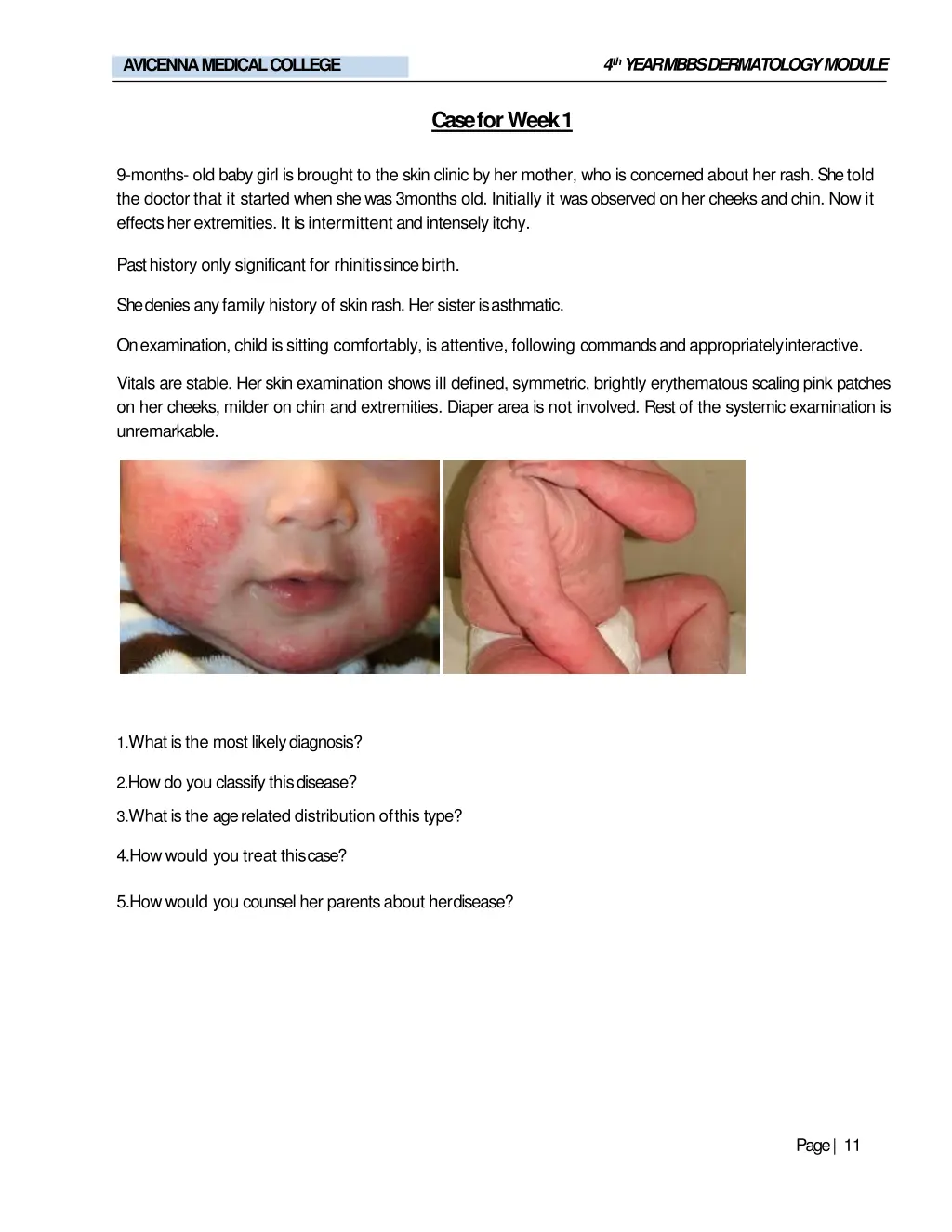 4 th year mbbs dermatologymodule 8