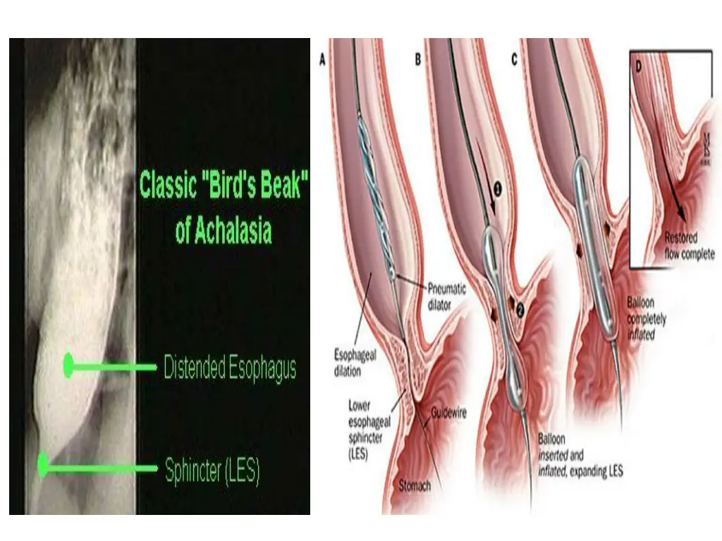 slide11