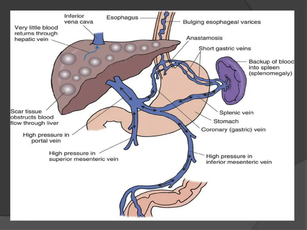 slide15