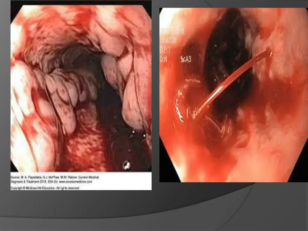 slide2