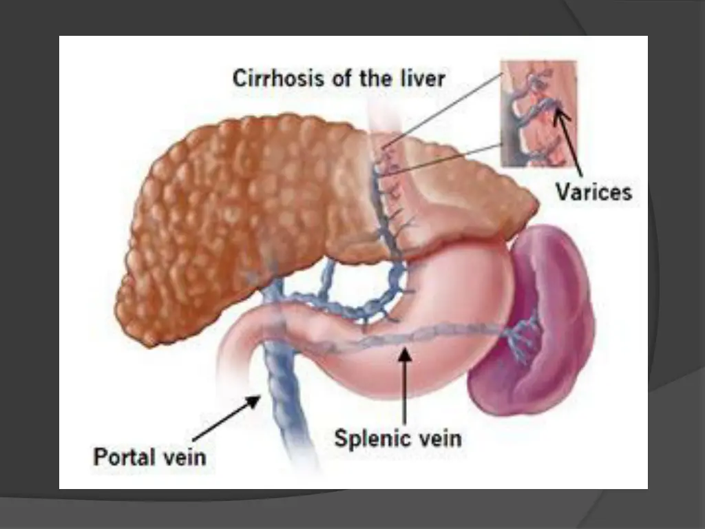 slide9