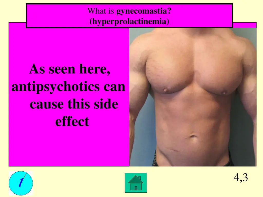 what is gynecomastia hyperprolactinemia