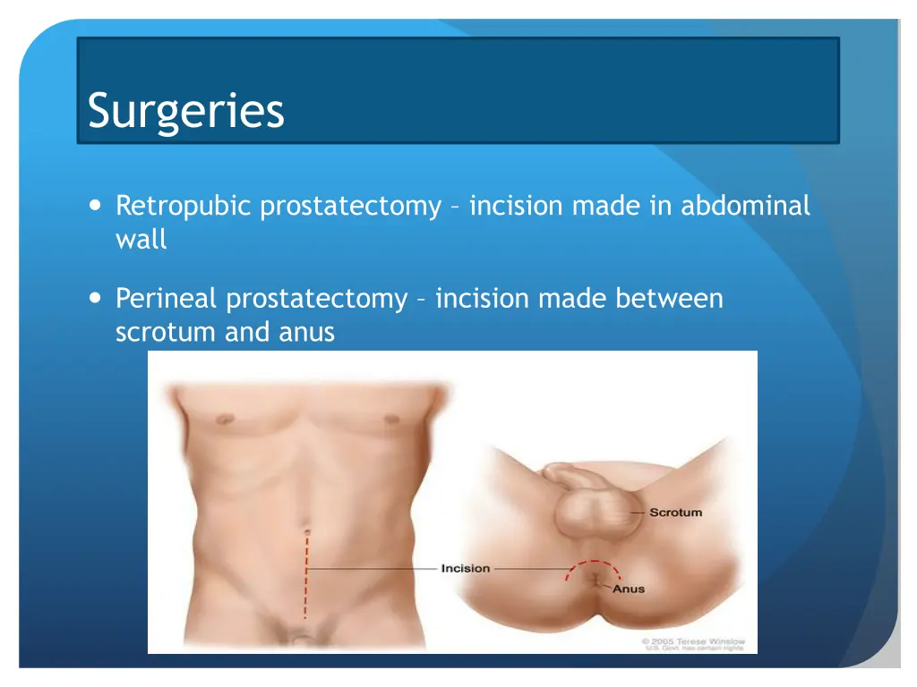 surgeries