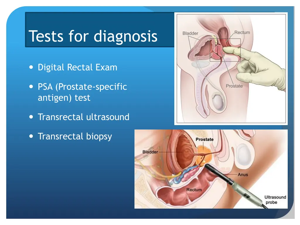 tests for diagnosis