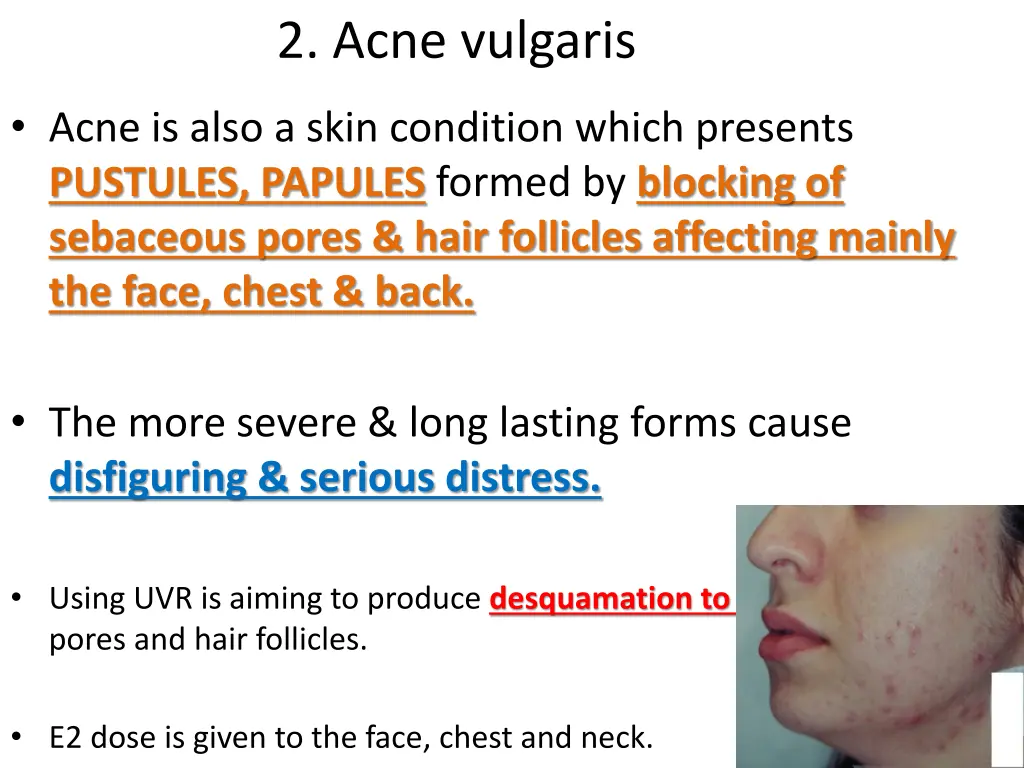 2 acne vulgaris