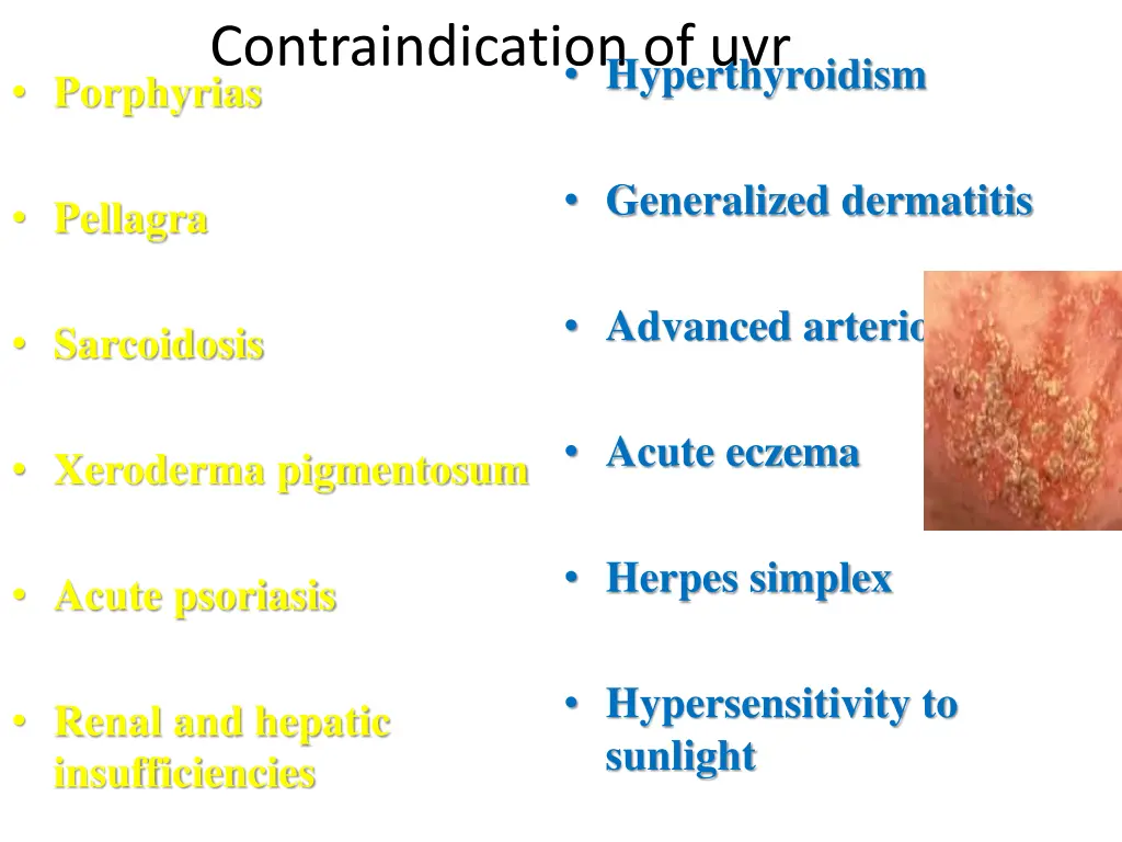 contraindication of uvr porphyrias