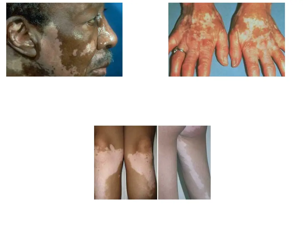 slide33