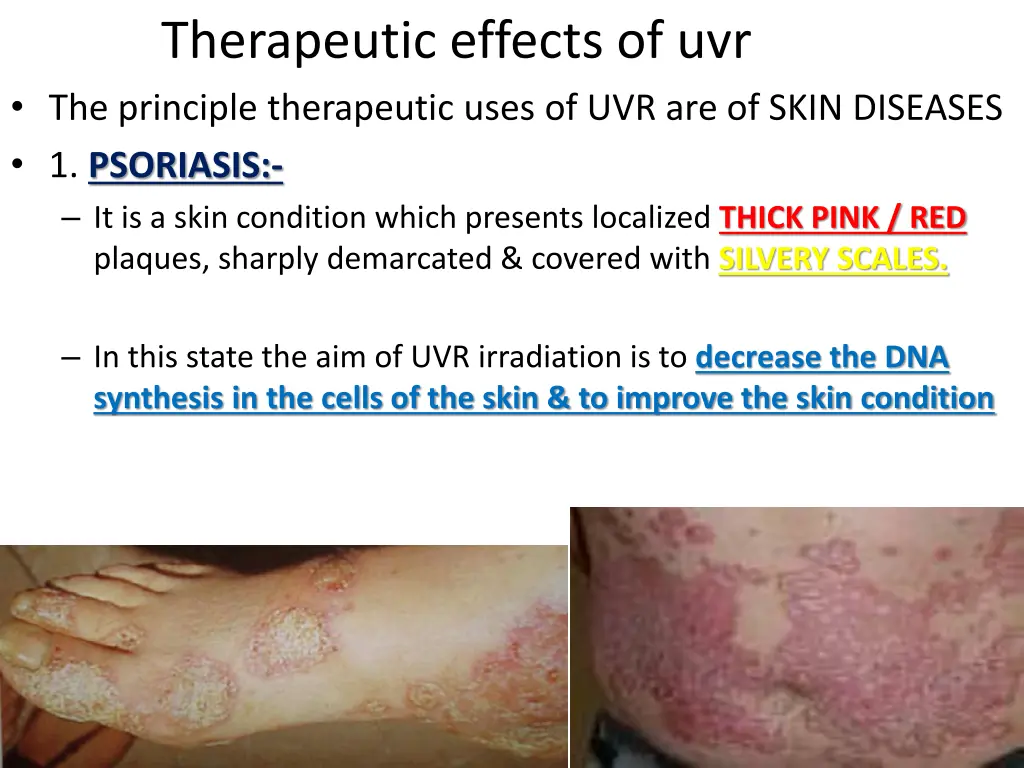 therapeutic effects of uvr the principle