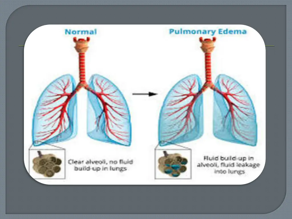 slide13
