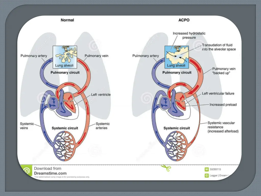 slide15