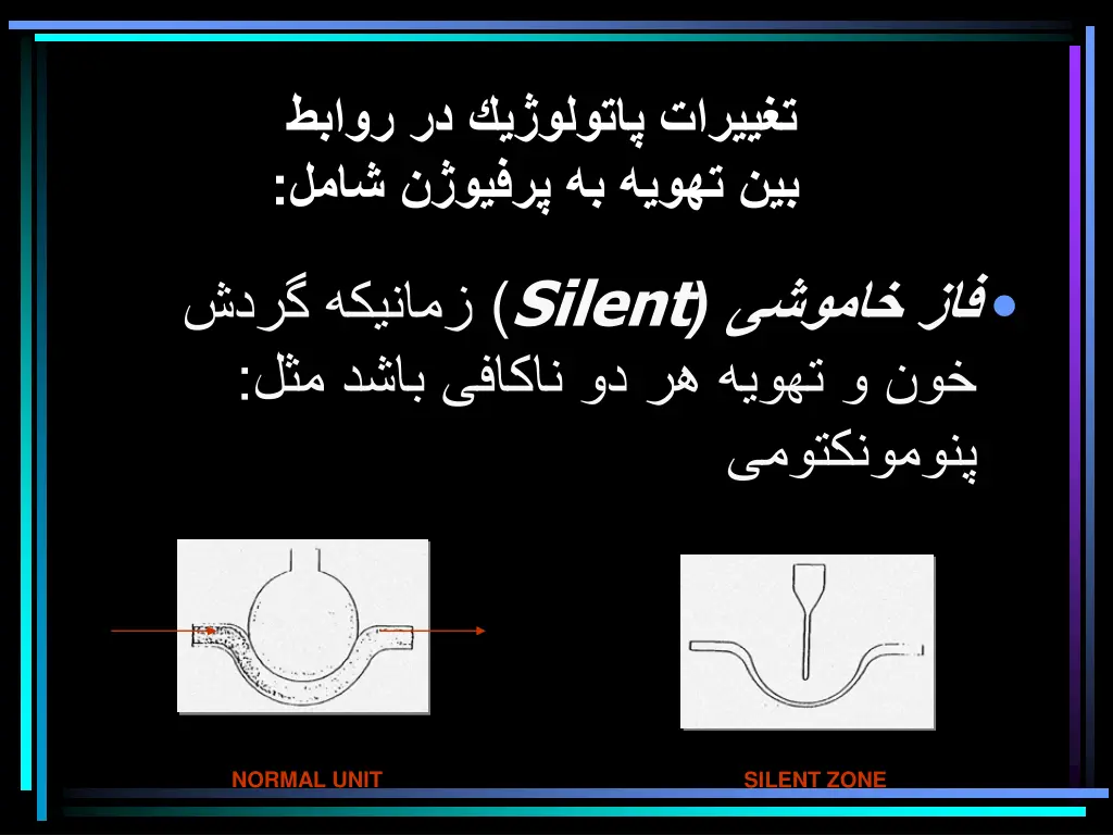 slide32