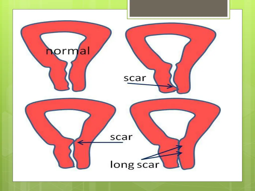 slide23