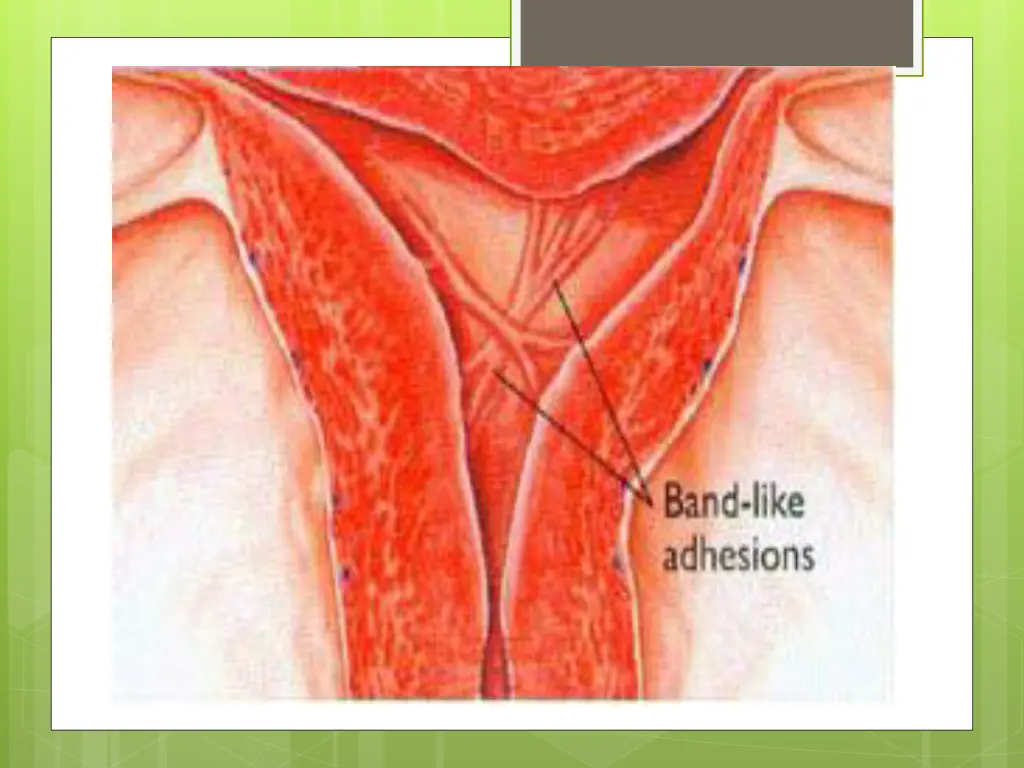 slide24