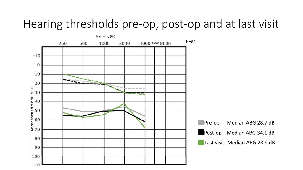 hearing thresholds pre op post op and at last