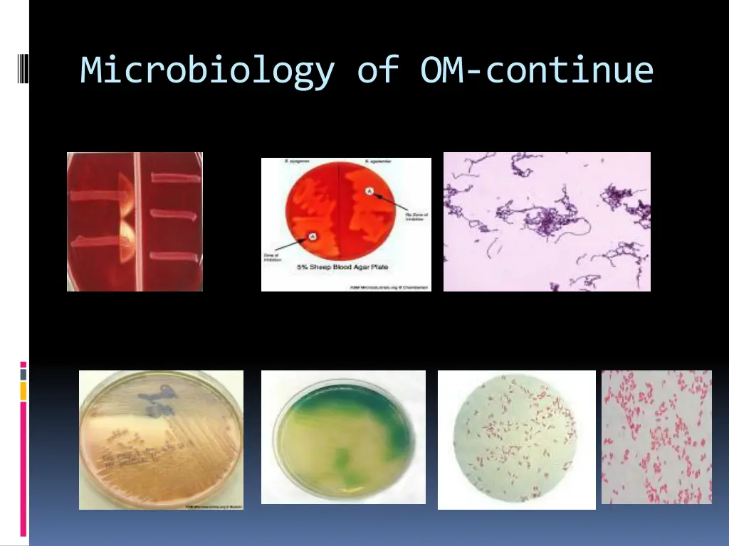 microbiology of om continue