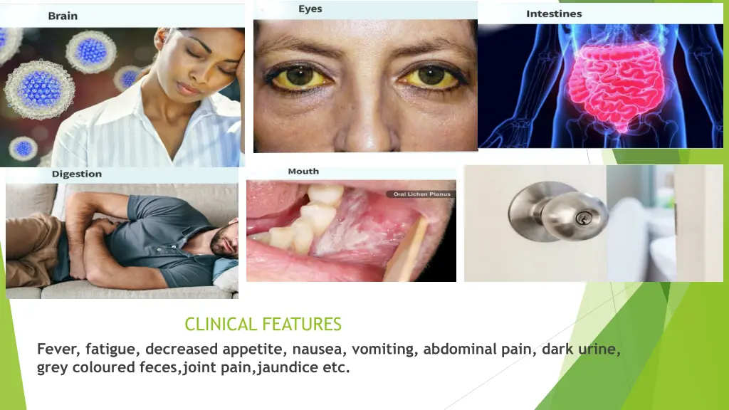 clinical features