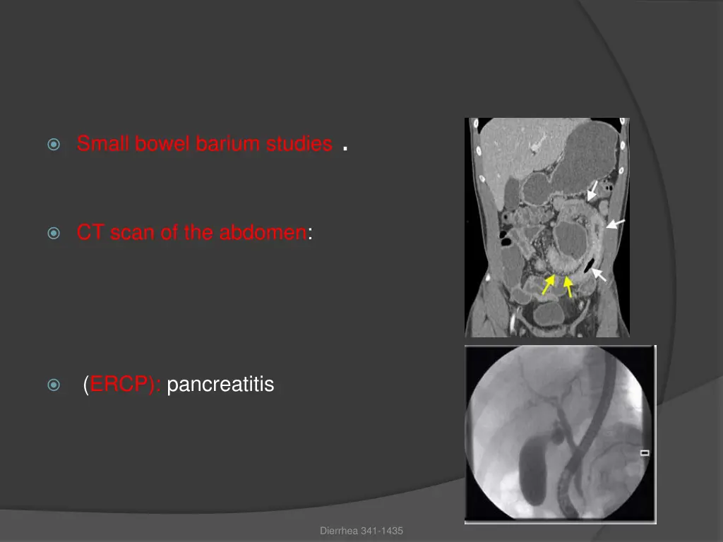 small bowel barium studies