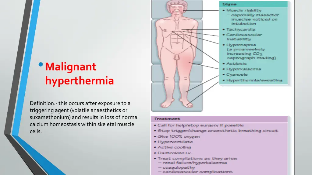 malignant hyperthermia