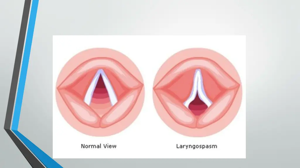 slide14