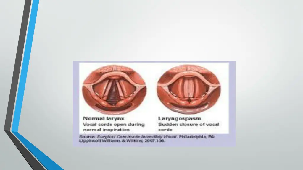 slide15