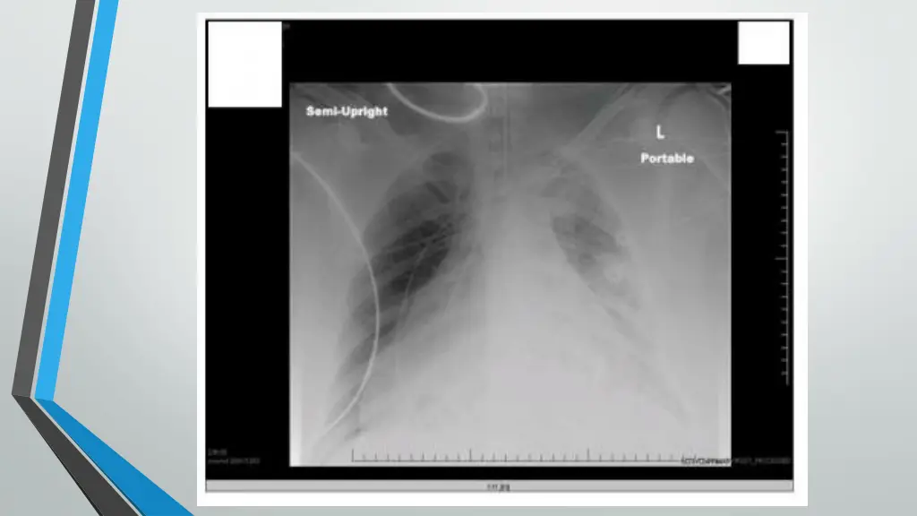 slide8