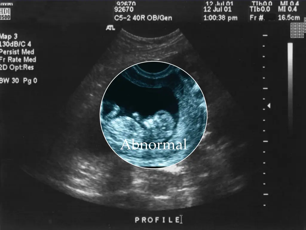 abnormal