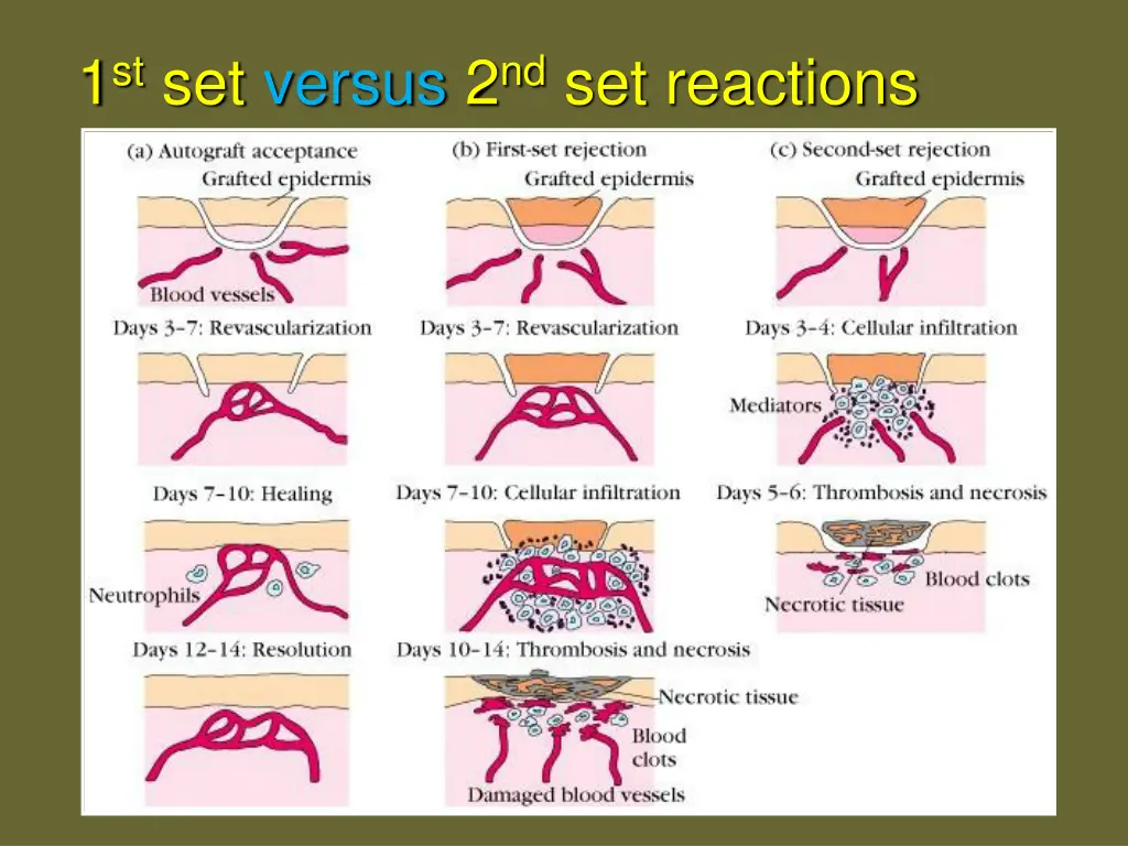 1 st set versus 2 nd set reactions