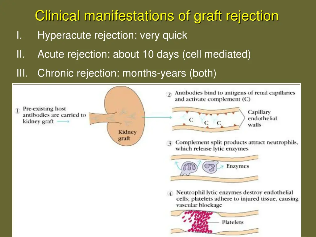 clinical manifestations of graft rejection