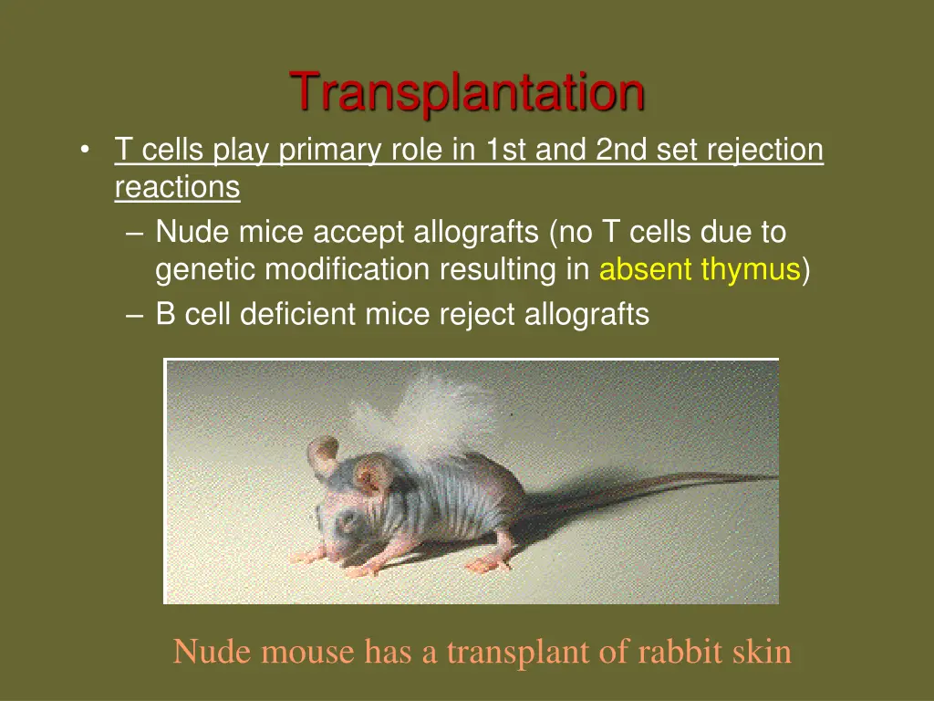 transplantation 3